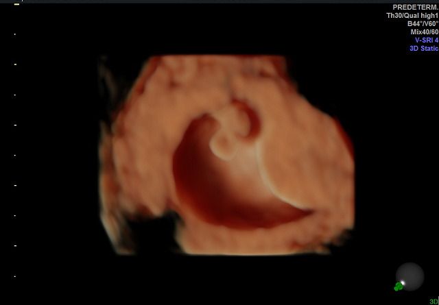 Graciela Elizabeth De La Torre Alvarez-21