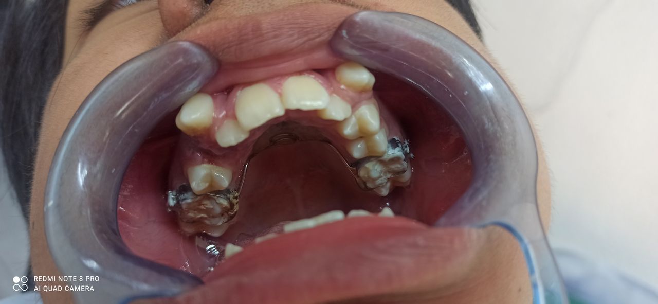 Oscar Cortez Perez-14