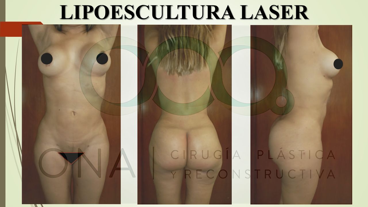 José Luis Segura Castillo-6