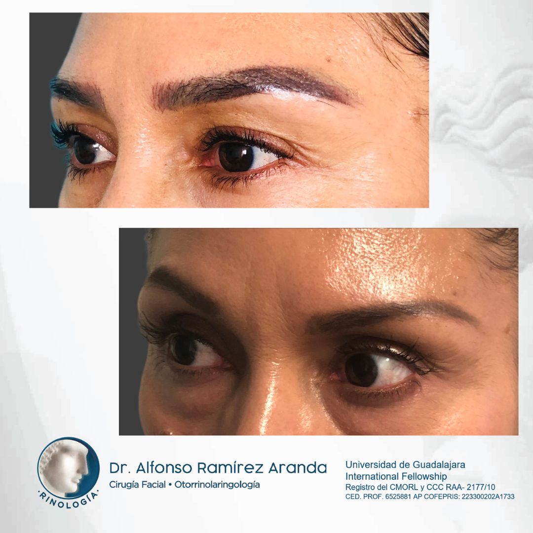 Alfonso Ramírez Aranda-9