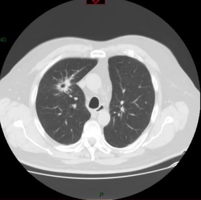 Alejandro Marin Castañeda Baron-11