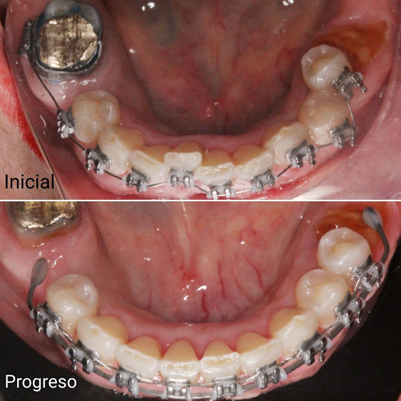 Aide Montserrat Orozco Gutierrez-42