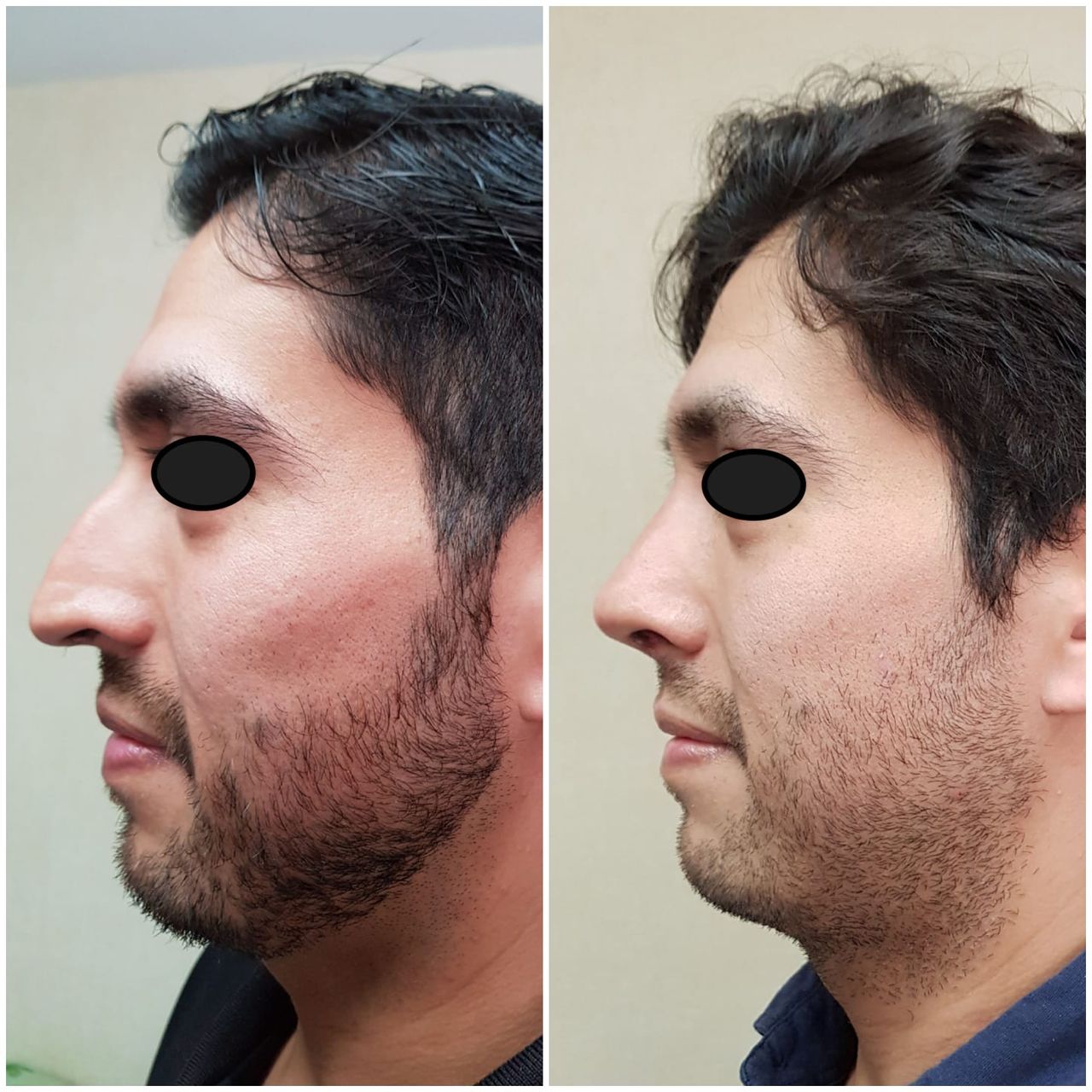 Fernando Nicolas Gonzalez Gonzalez-21