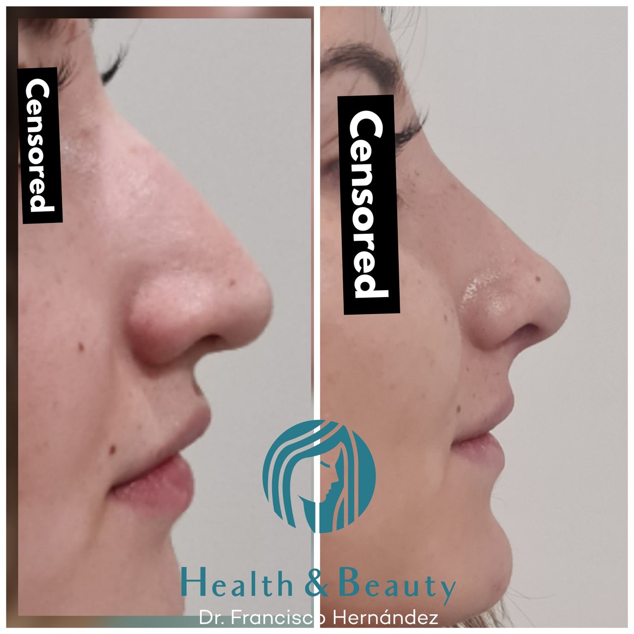 Francisco Hernández Gómez Crespo-99