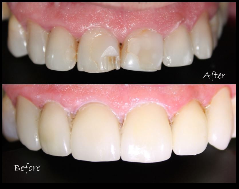 Aimee Valles Monárrez-29