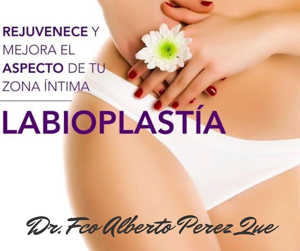 Francisco Alberto Perez Que-34