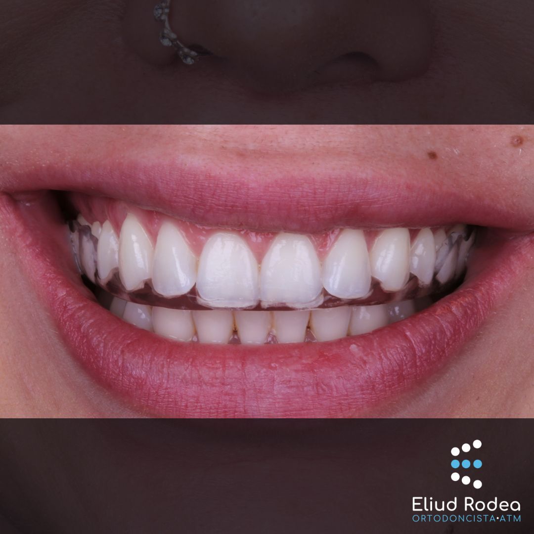 Eliud Rodea Monsivais-5