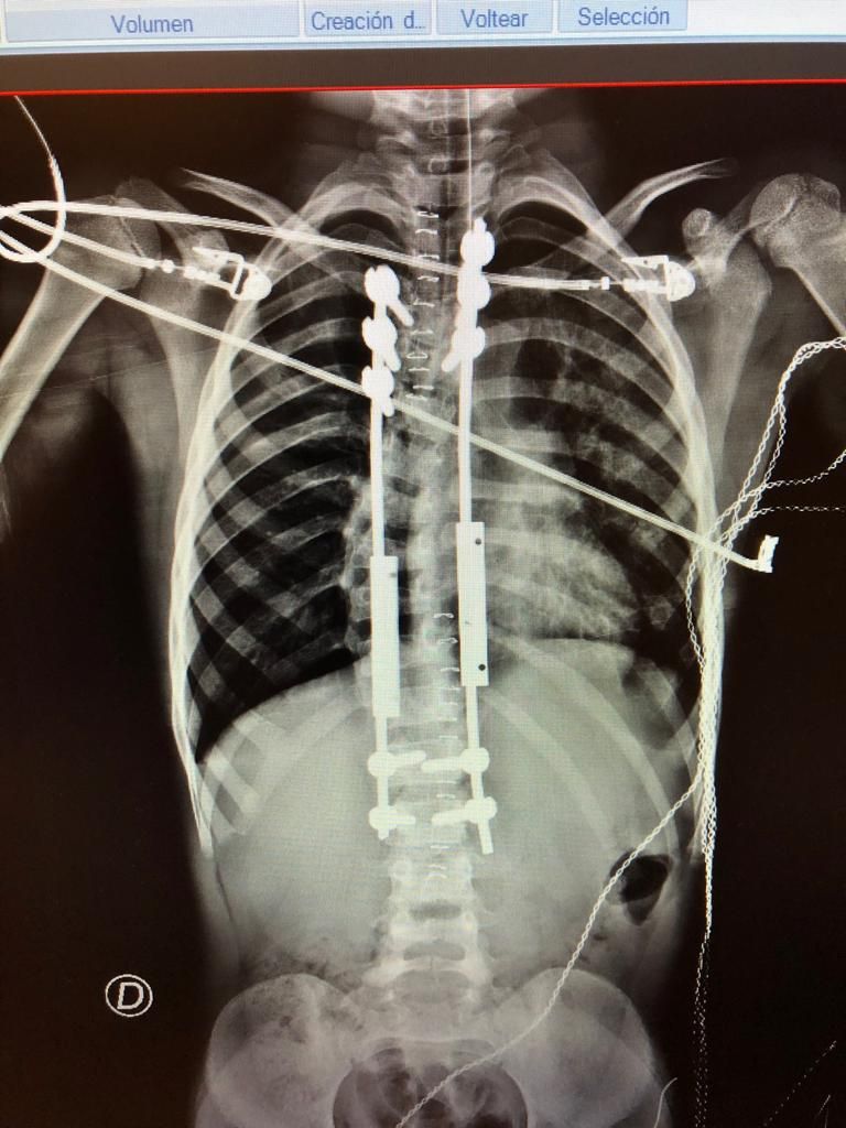 José Antonio Canales Najera-15