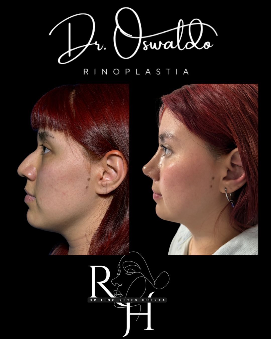 Lino Oswaldo Reyes Huerta-0