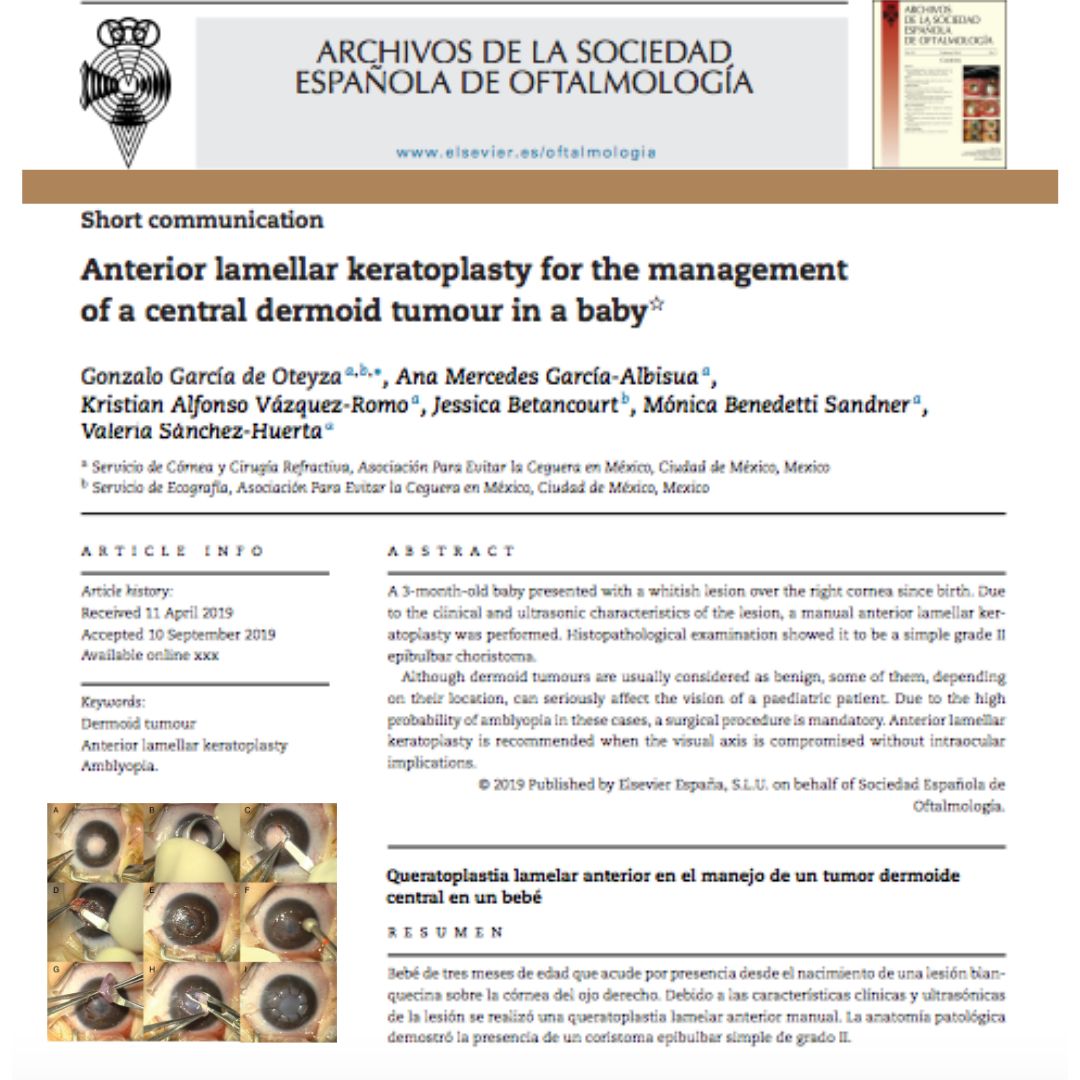 Kristian Alfonso Vazquez Romo-38