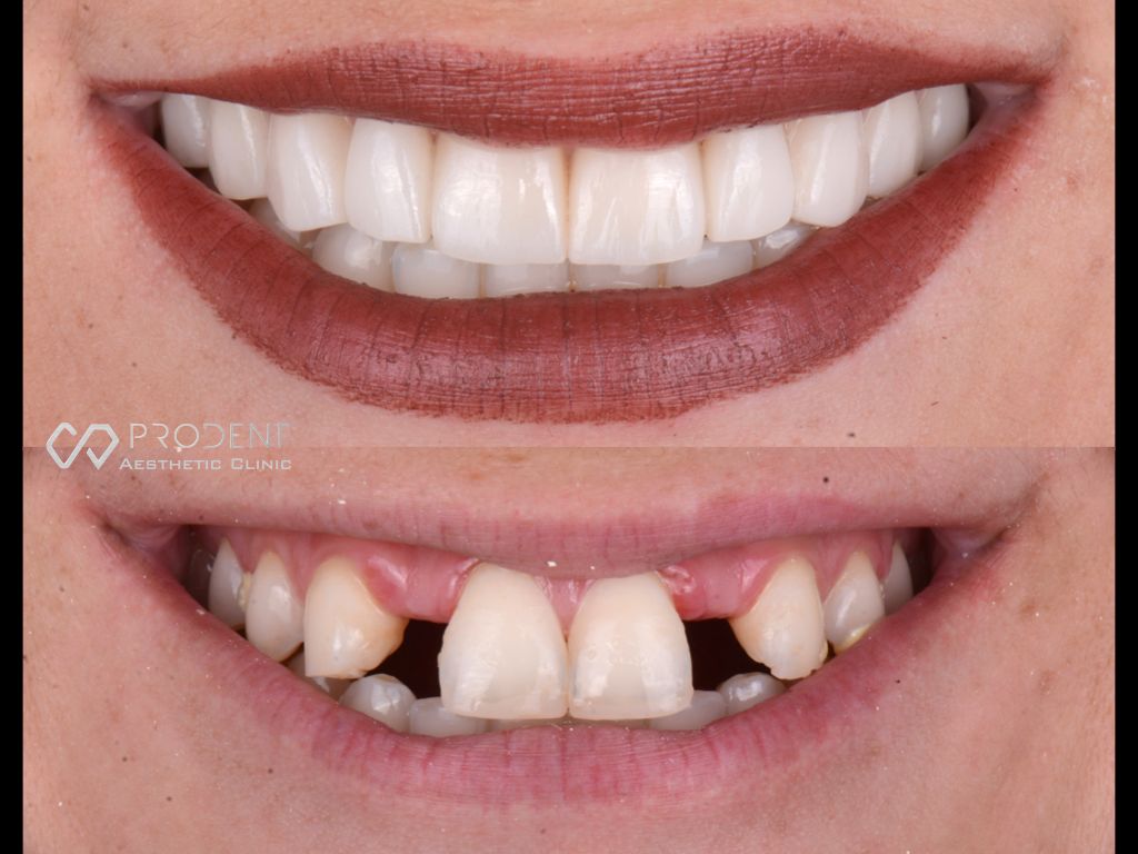 Ramiro Ivan Pérez Murillo-7