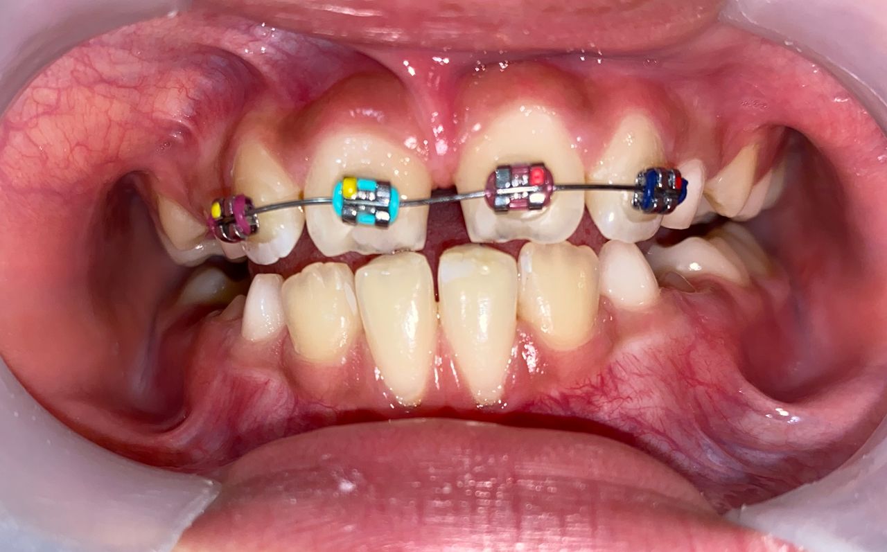 Mirely Peralta Rodríguez-7