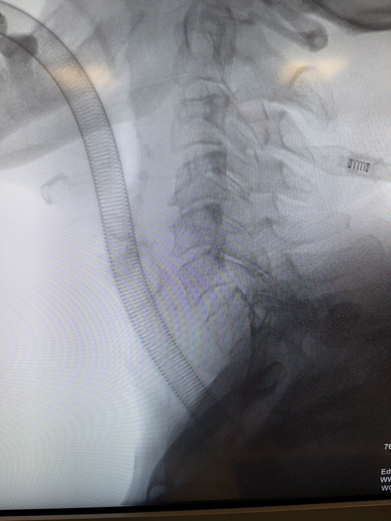 Alejandro Serrano Rubio-22