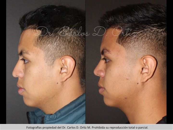 Carlos David Ortiz Moreno-34