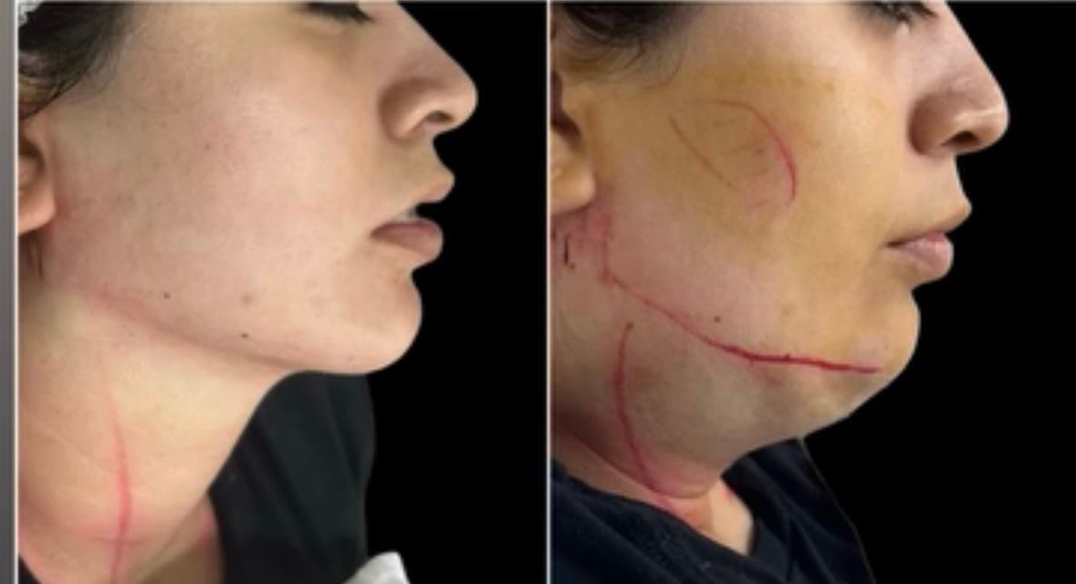 Nancy Valeria Lara Gayosso-10