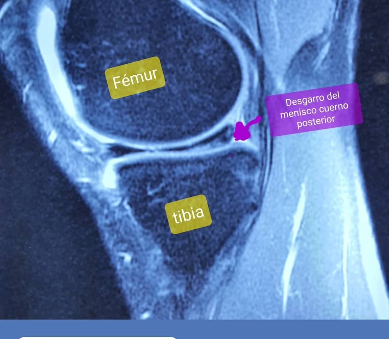 José Antonio Algarín Reyes-11