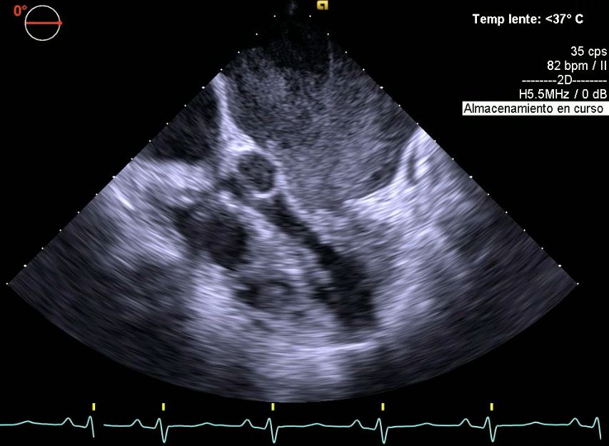 Luis Augusto Baeza Herrera-1