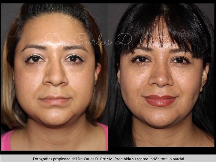 Carlos David Ortiz Moreno-19