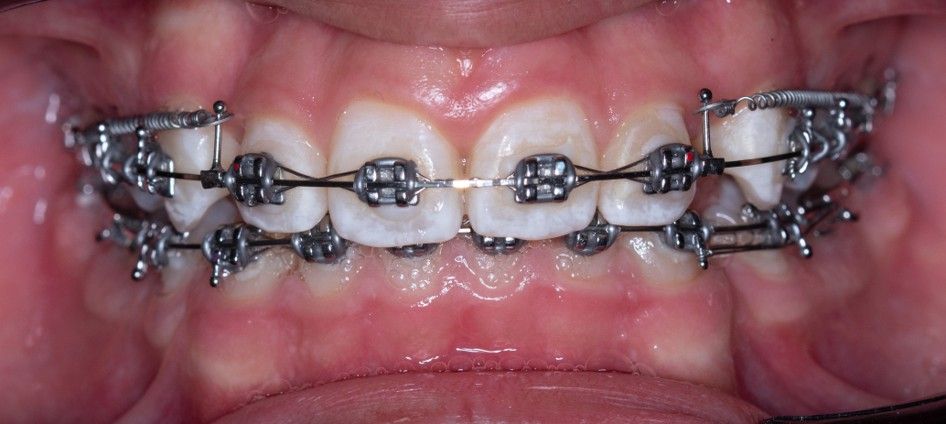 Vicente Emmanuel Silva Rangel-14