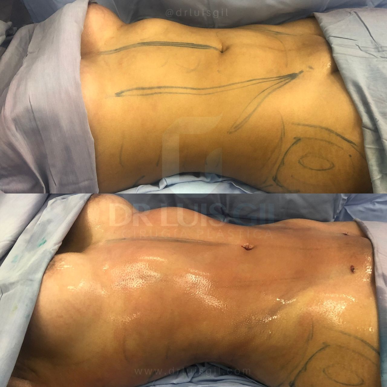 Luis Atilio Gil Pérez-20