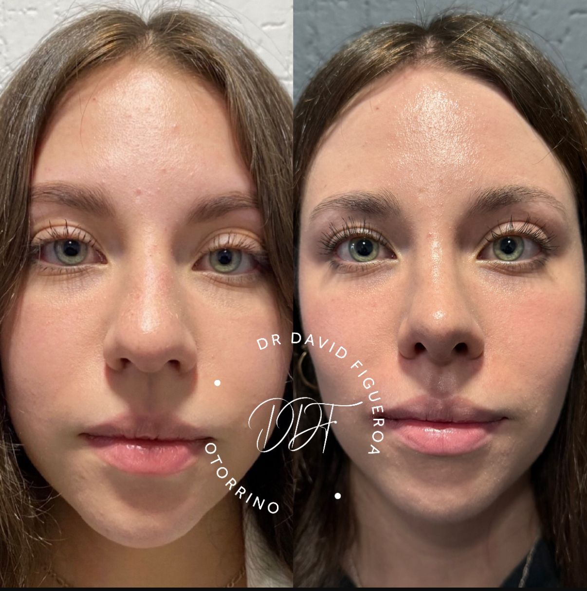 David Daniel Figueroa Hernandez-0