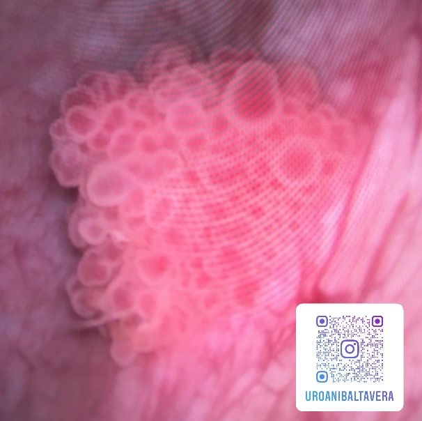 Anibal Tavera Sánchez-4