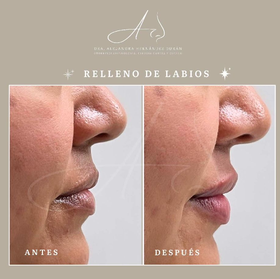 Alejandra Elizabeth Hernández Durán-14