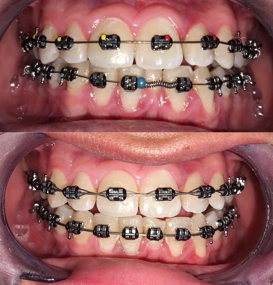 Luz Anel Valente Lozano-5