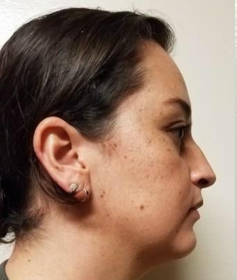 Alberto Wintergerst Fisch-32