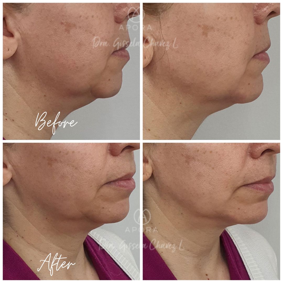 Gissela Chávez Lizardi-28