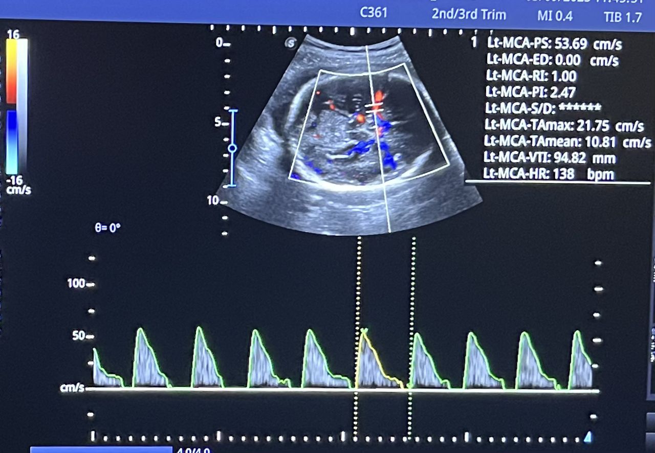 César Guerra Martínez-44