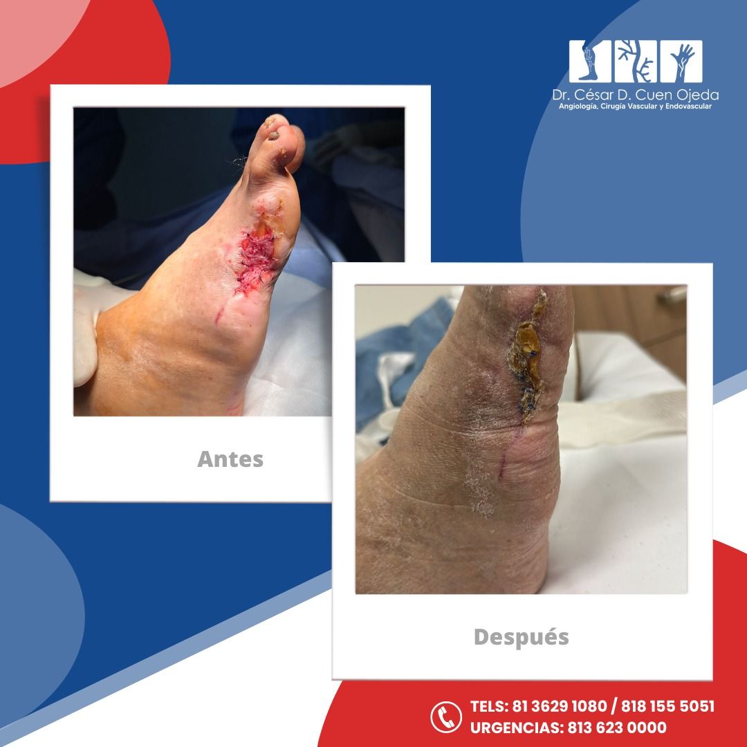 César Daniel Cuen Ojeda-19