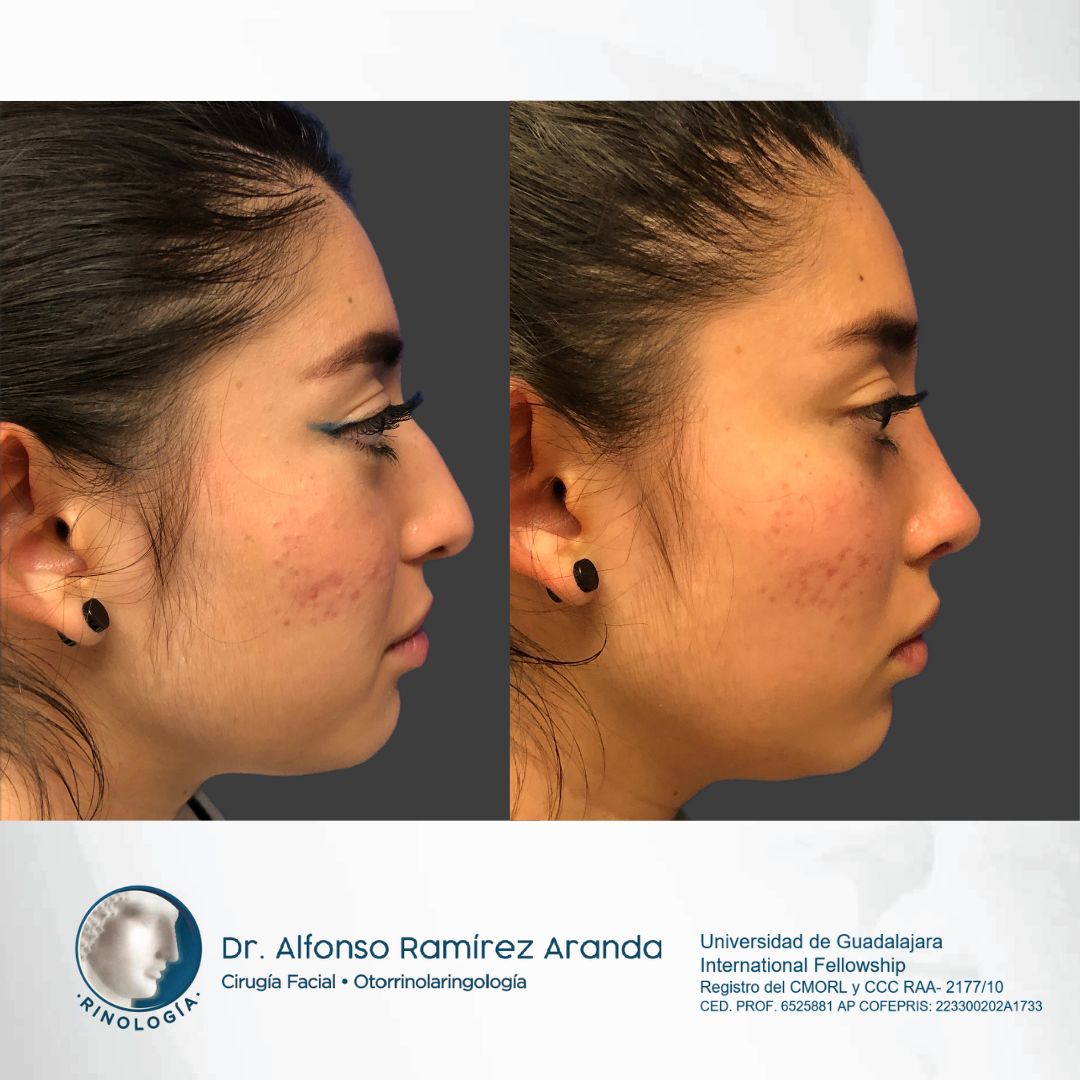 Alfonso Ramírez Aranda-23