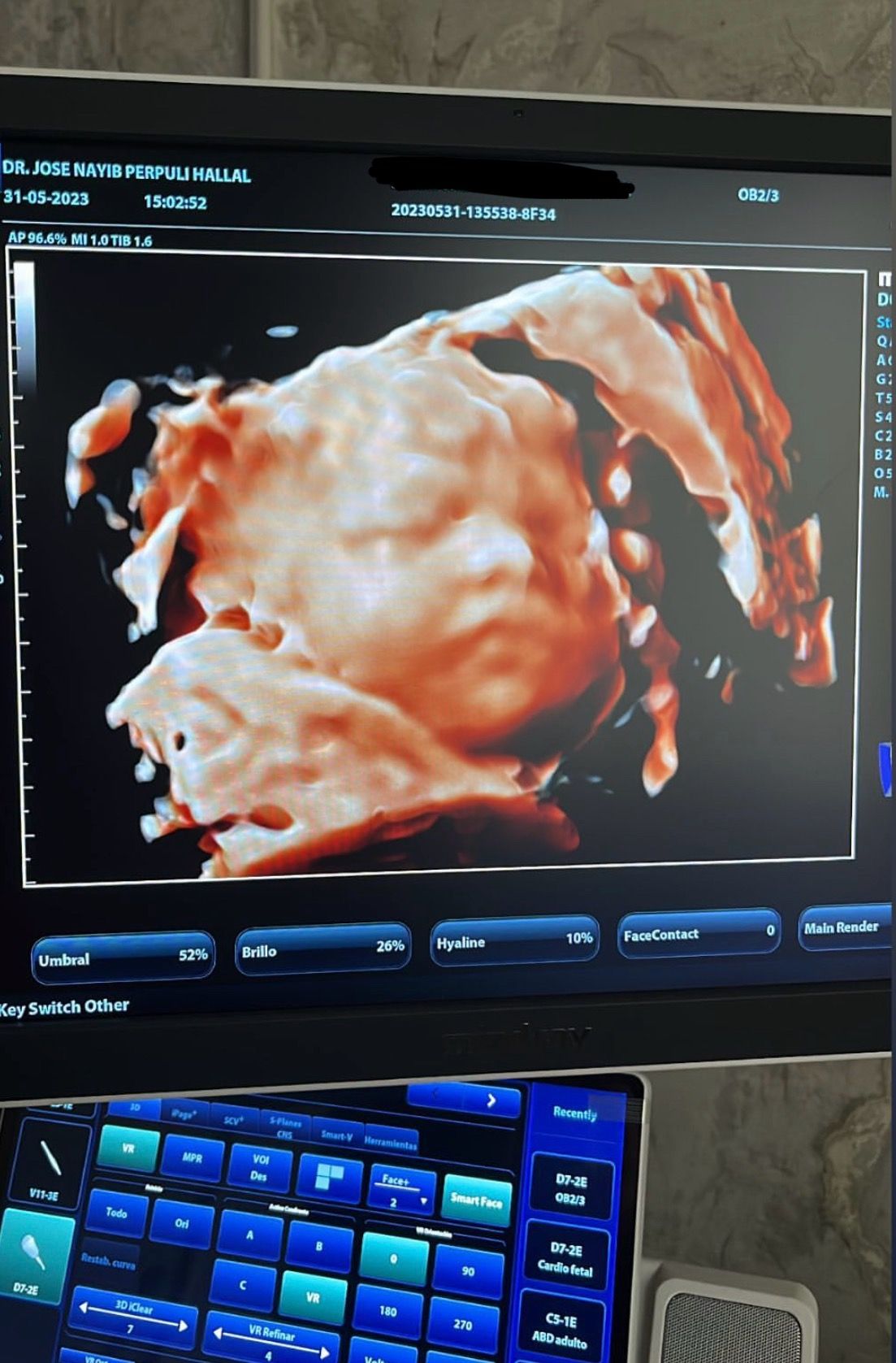 José Nayib Perpuli Hallal-2