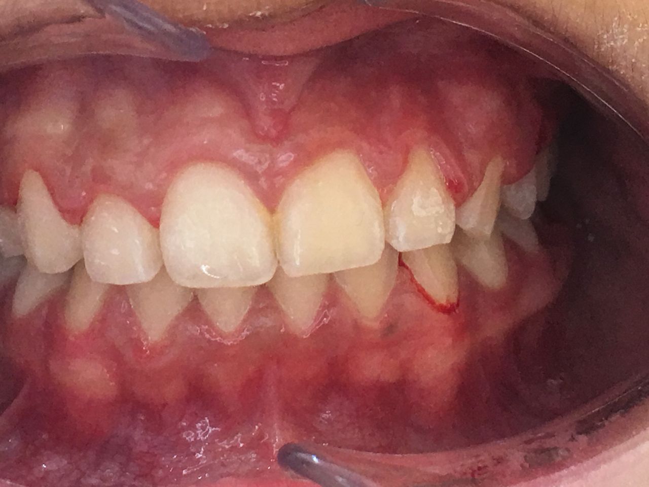 Patricia Rizo Palos-11