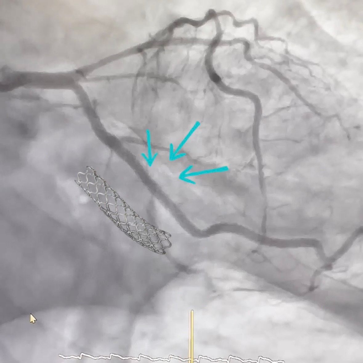 Erick Dante Martinez Maldonado-5