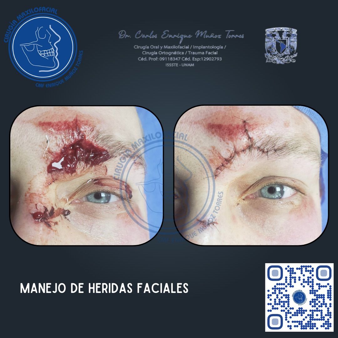 Carlos Enrique Muñoz Torres-7