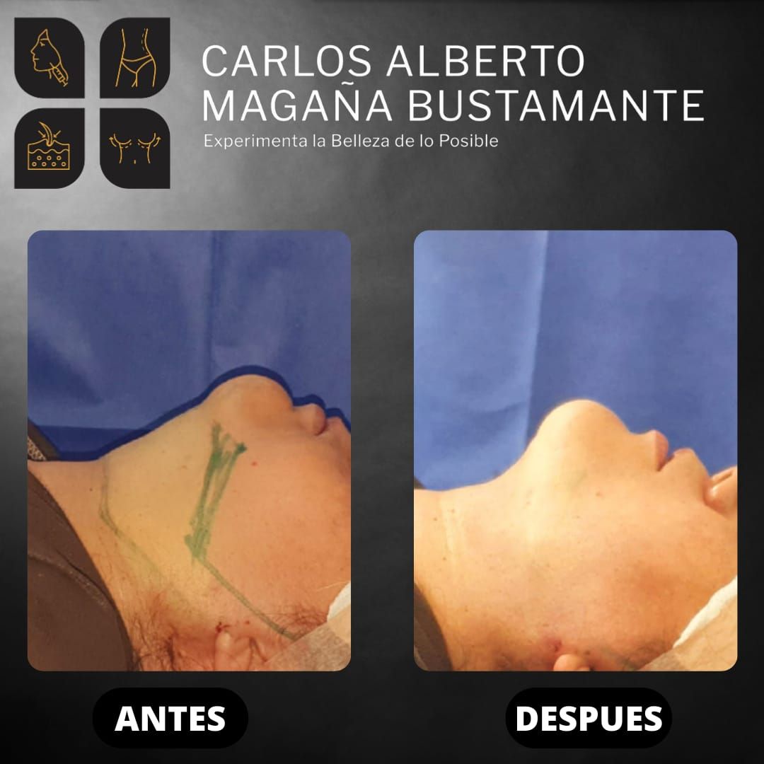 Carlos Alberto Magaña Bustamante-11