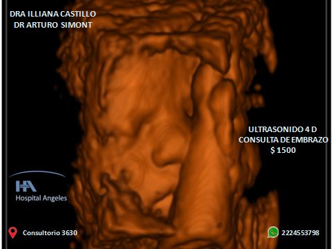 Arturo Simont Zeron-9