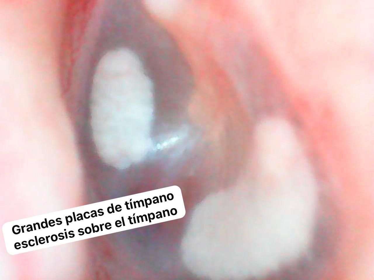 Nuria Esperanza Boronat Echeverria-23