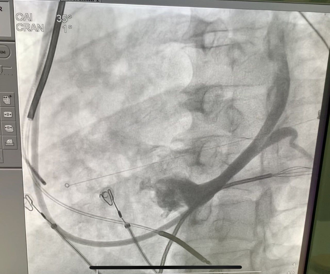 Karim Yarek Juarez Escobar-10