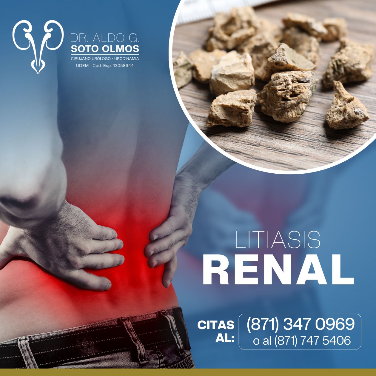 Aldo Giovanne Soto Olmos-6