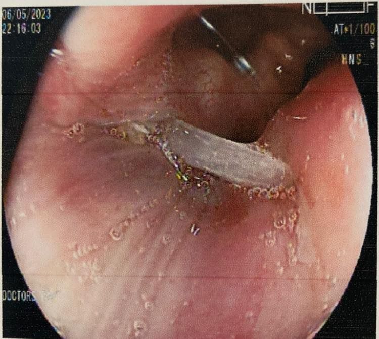 J. César Reyes Vásquez-10