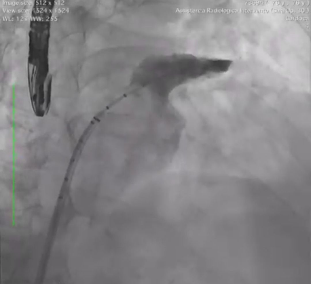 Elihu Durán Cortés-11