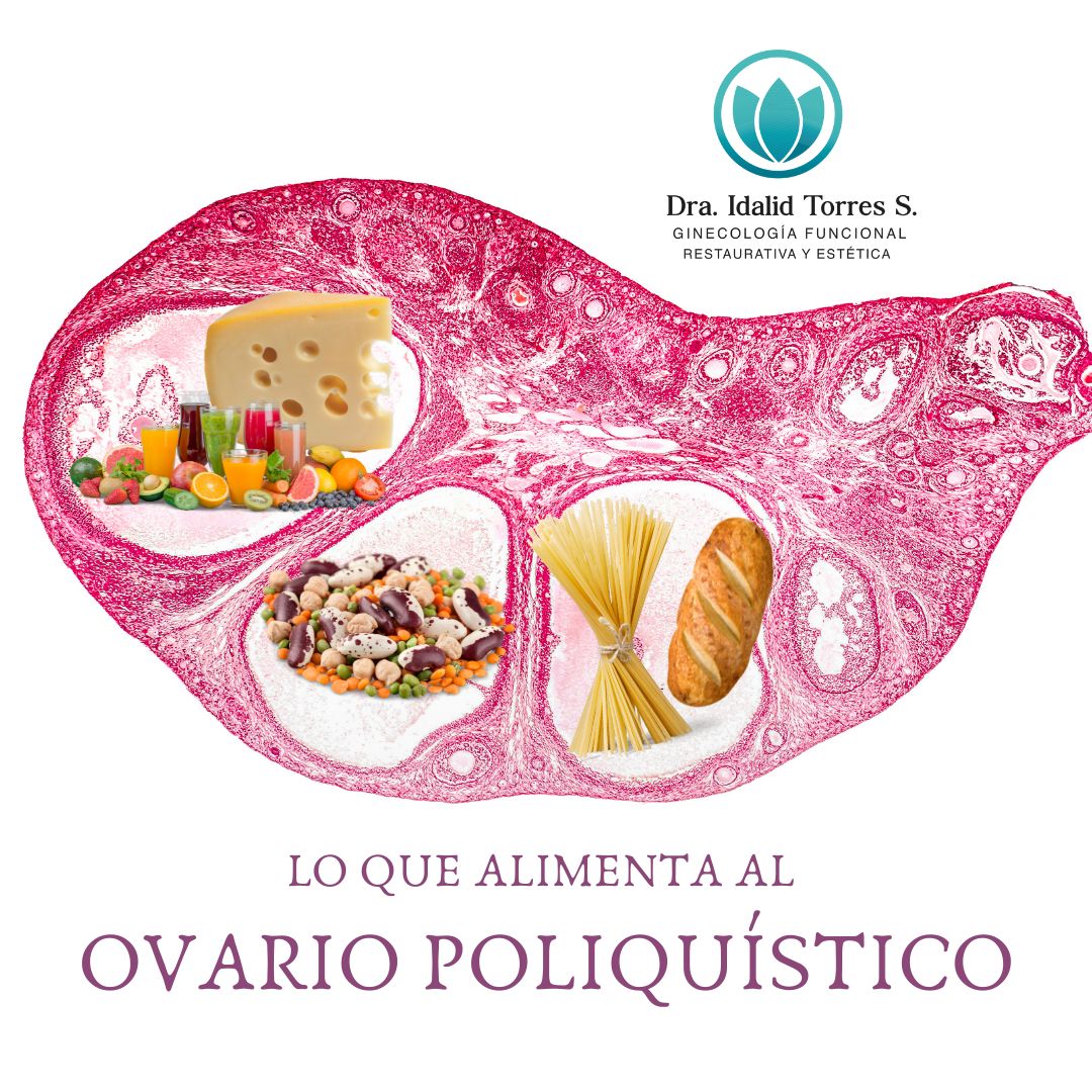 Idalid Torres Sánchez-14