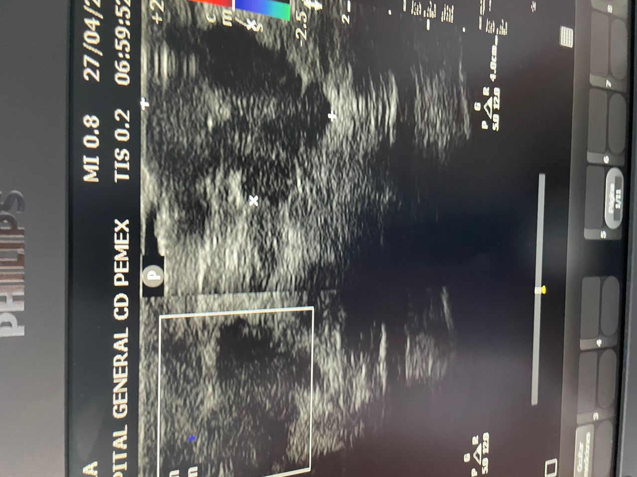 José Ismael Pineda Pérez-4