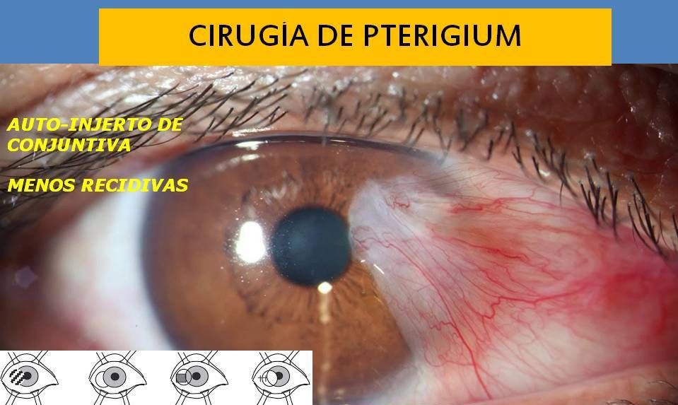 Armando Capote Cabrera-4