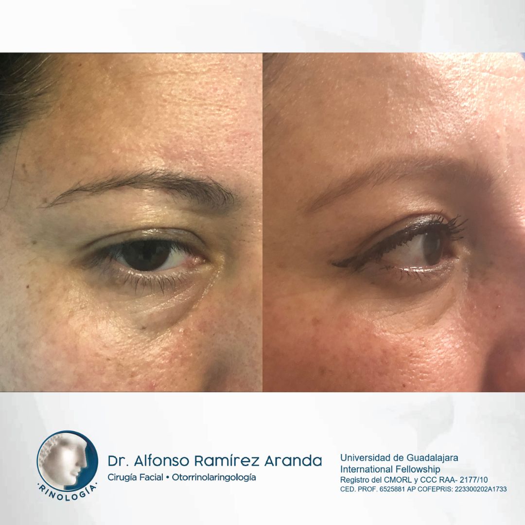 Alfonso Ramírez Aranda-6