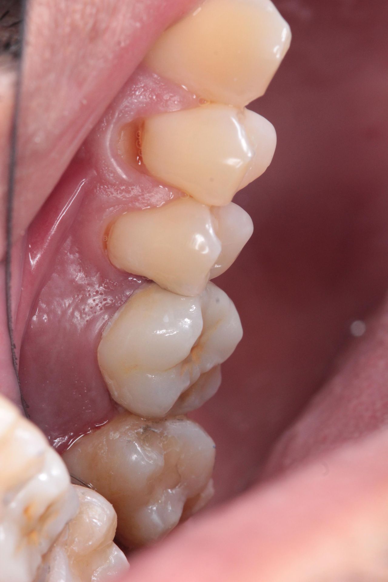 Antonio Fuentes Rodriguez-9