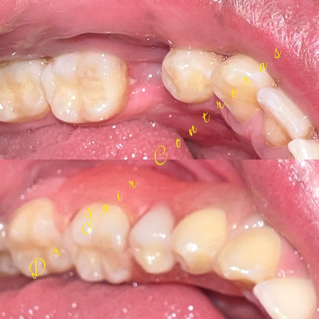 Jair Contreras García-12